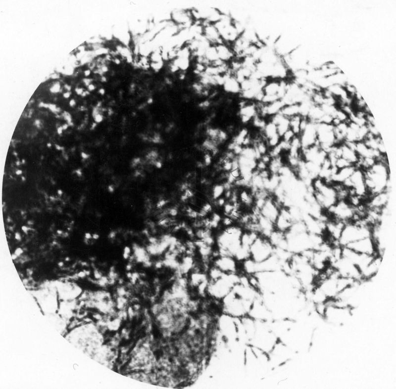 Leptomonas in stomaco di Flebotomo