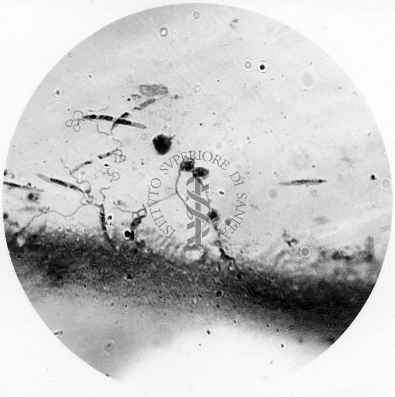 Leptomonas in stomaco di Flebotomo