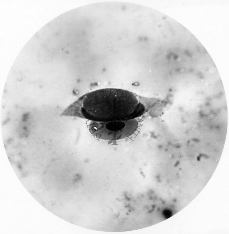 Leucocytozoon contenuti entro un globulo bianco e completamente abbracciati dal nucleo