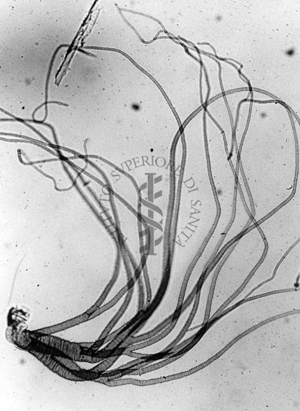 Organo respiratorio pupale di Simulide (Diptera, SImulidae)