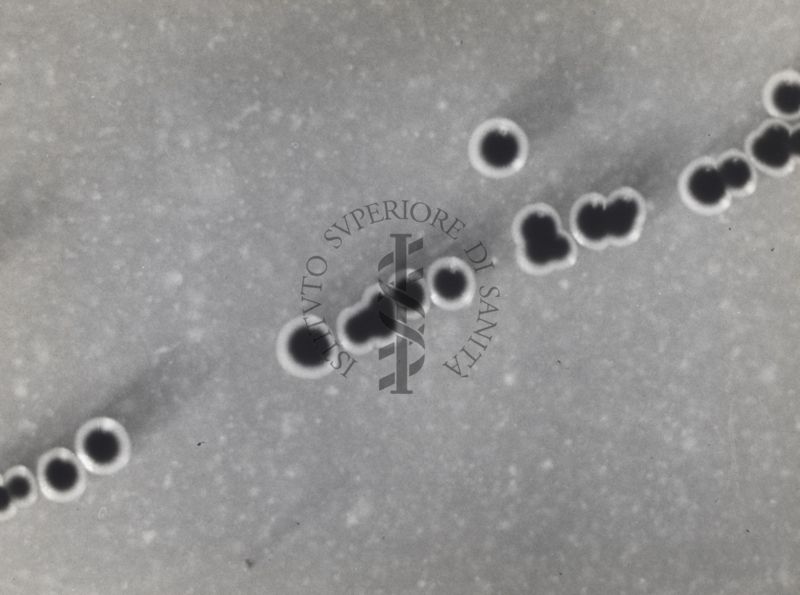 Fotografie di Corynebacterium diphtheriae