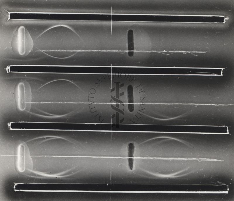 Fotografia di Immunoelettroforesi di microbatteri