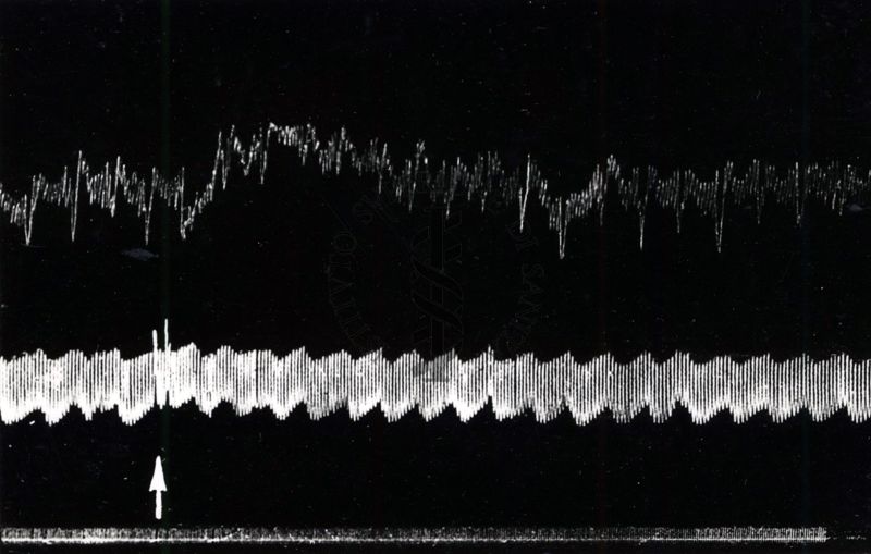 Azione di alcuni preparati solforati benzenici sulla pressione del sangue e sul ritmo respiratorio (su conigli)