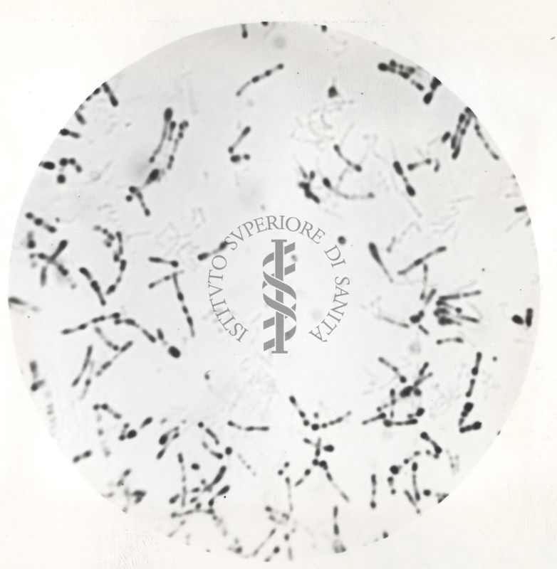 Microfotografie di Corynebacterium diphteriae