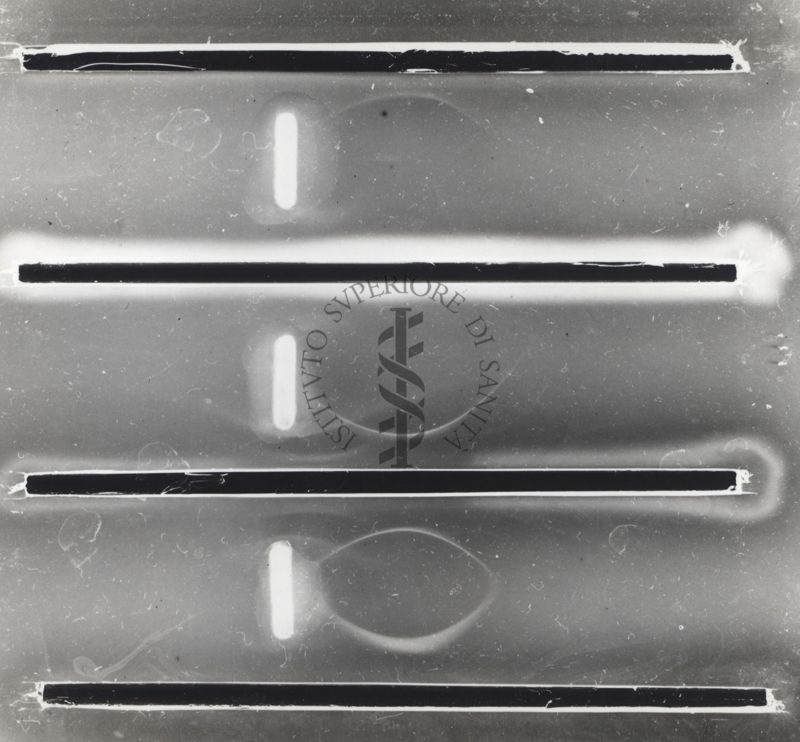 Immunoelettroforesi di micobatteri