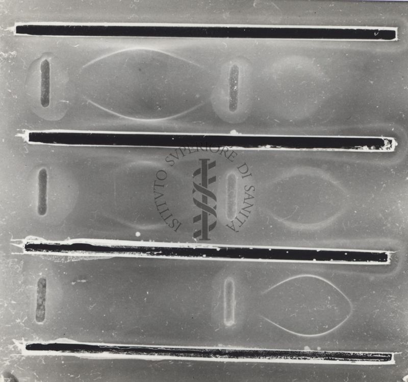 Immunoelettroforesi di micobatteri