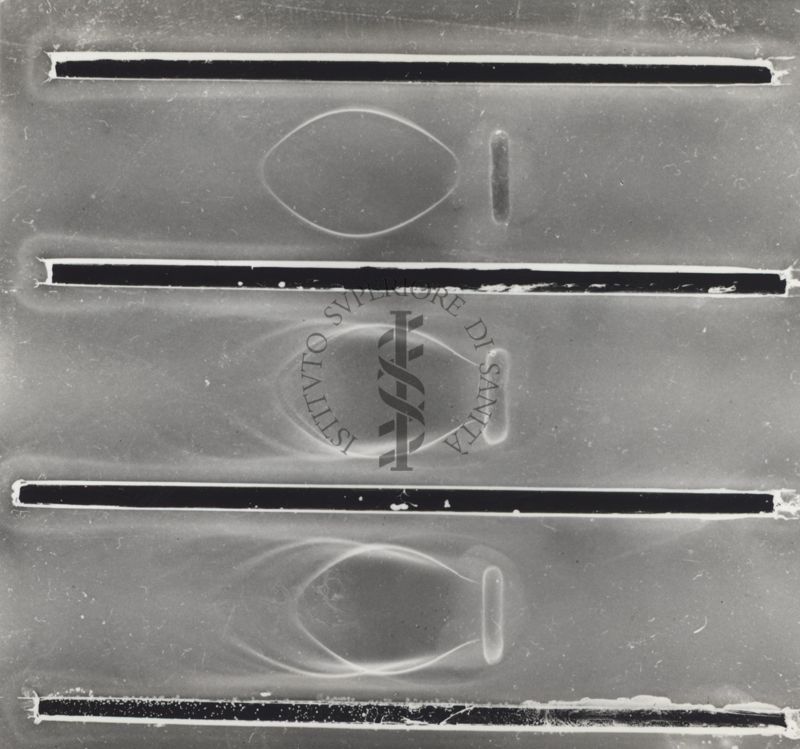 Immunoelettroforesi di micobatteri