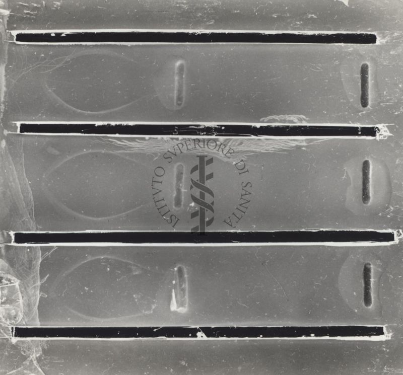 Immunoelettroforesi di micobatteri