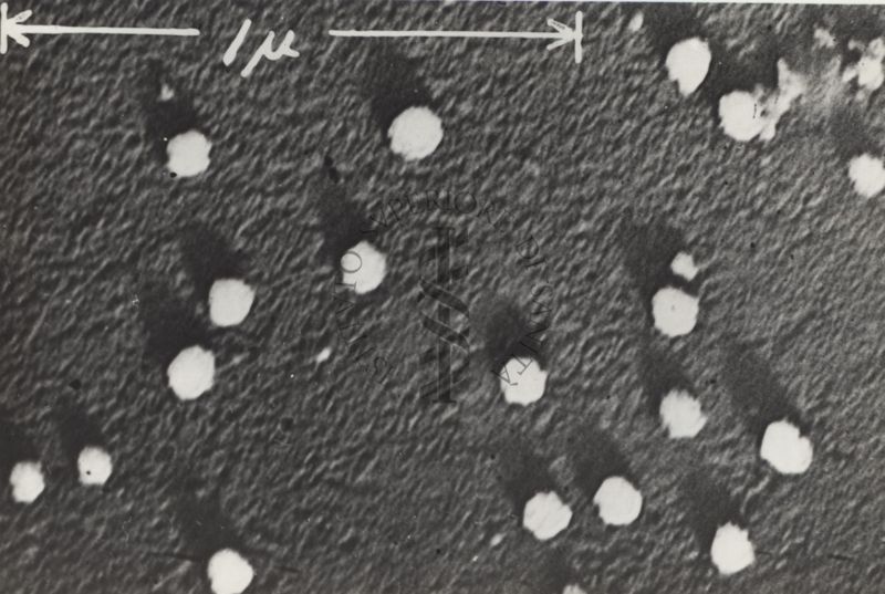 Sezioni osservate al Microscopio Elettronico