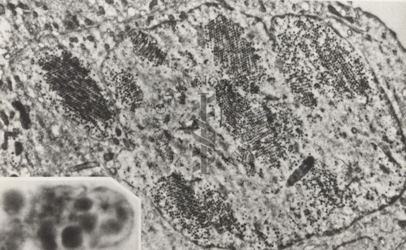 Sezioni osservate al Microscopio Elettronico