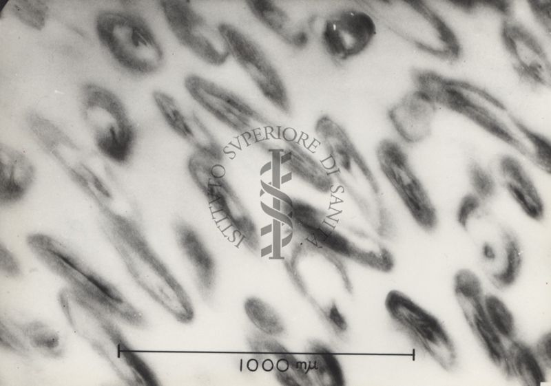 Sezioni osservate al Microscopio Elettronico