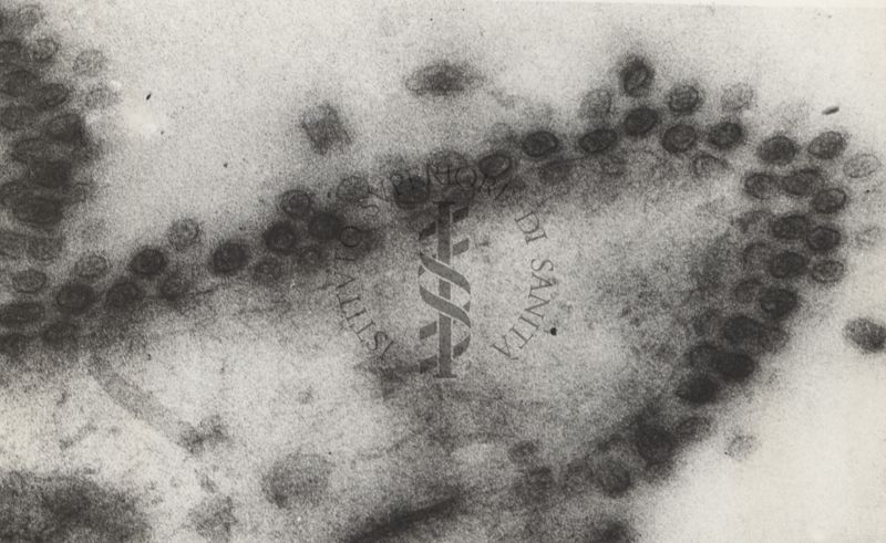 Sezioni osservate al Microscopio Elettronico