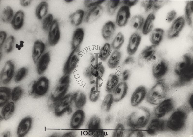 Sezioni osservate al Microscopio Elettronico