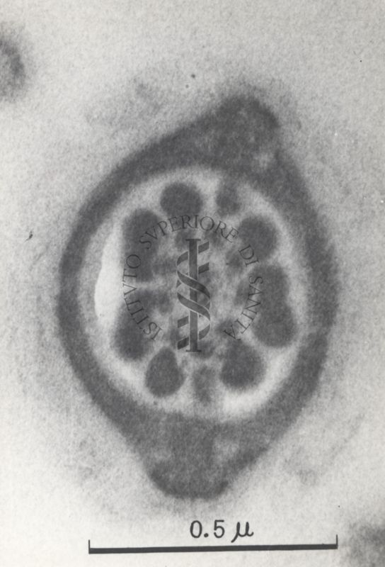 La spermatogenesi studiata al Microscopio elettronico