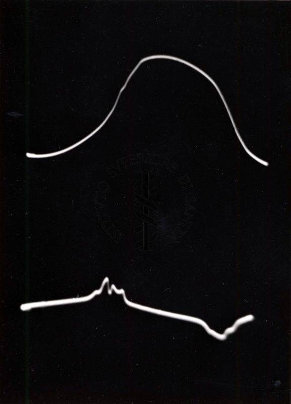 Oscillogramma della colchicina con ph 3,17