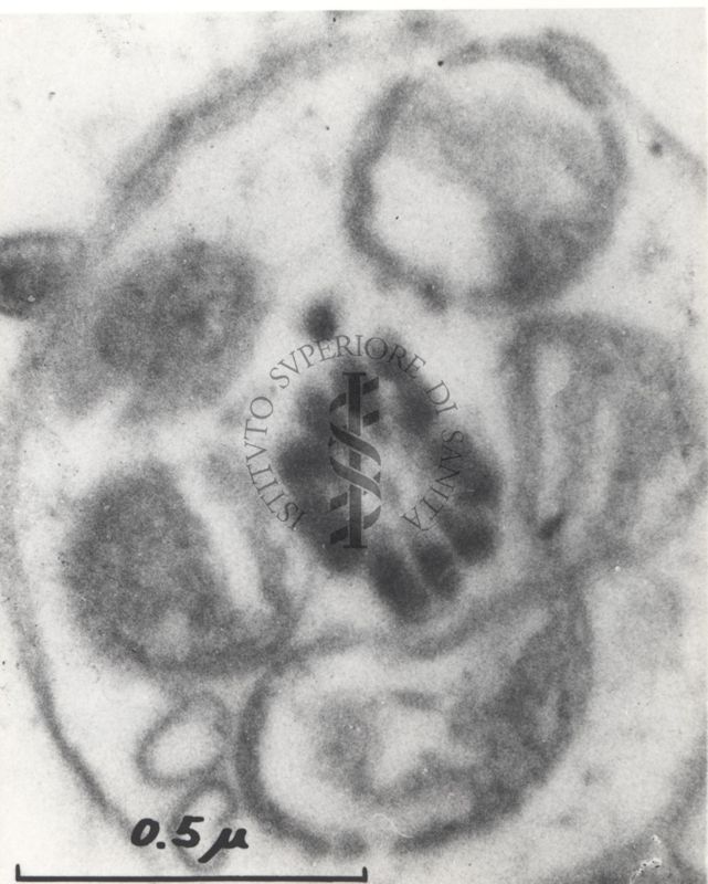 La spermatogenesi studiata al Microscopio elettronico