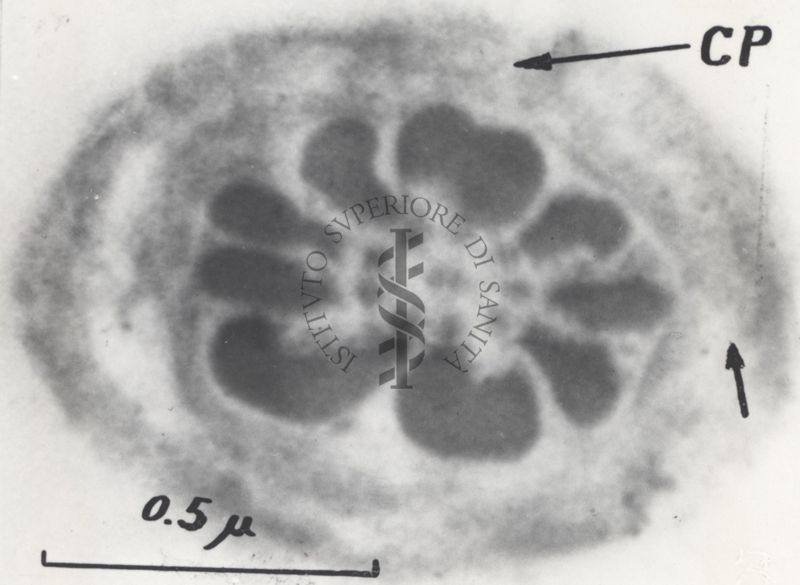 La spermatogenesi studiata al Microscopio elettronico