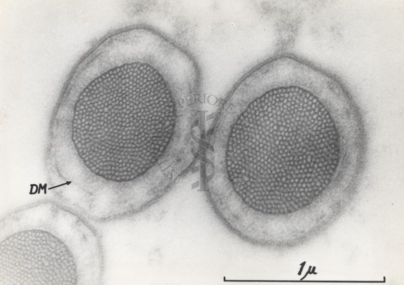 La spermatogenesi studiata al Microscopio elettronico