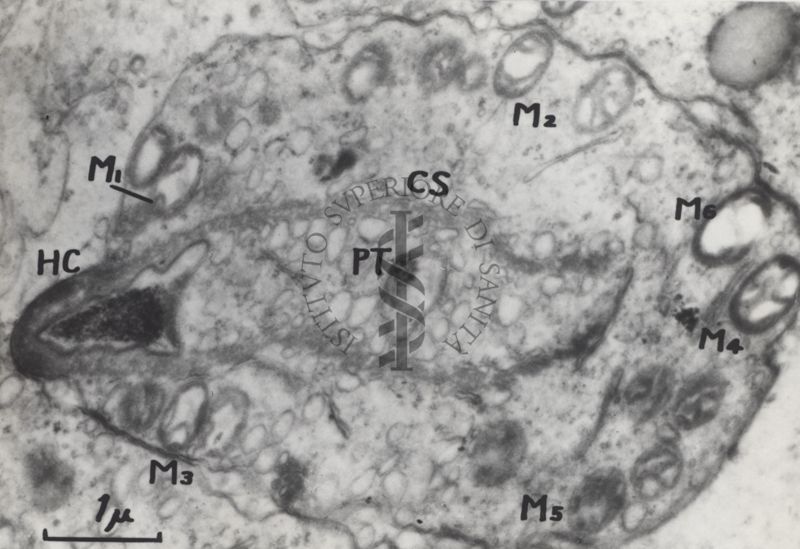 La spermatogenesi studiata al Microscopio elettronico