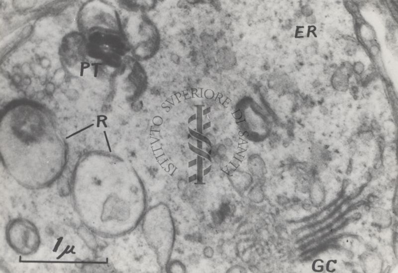 La spermatogenesi studiata al Microscopio elettronico