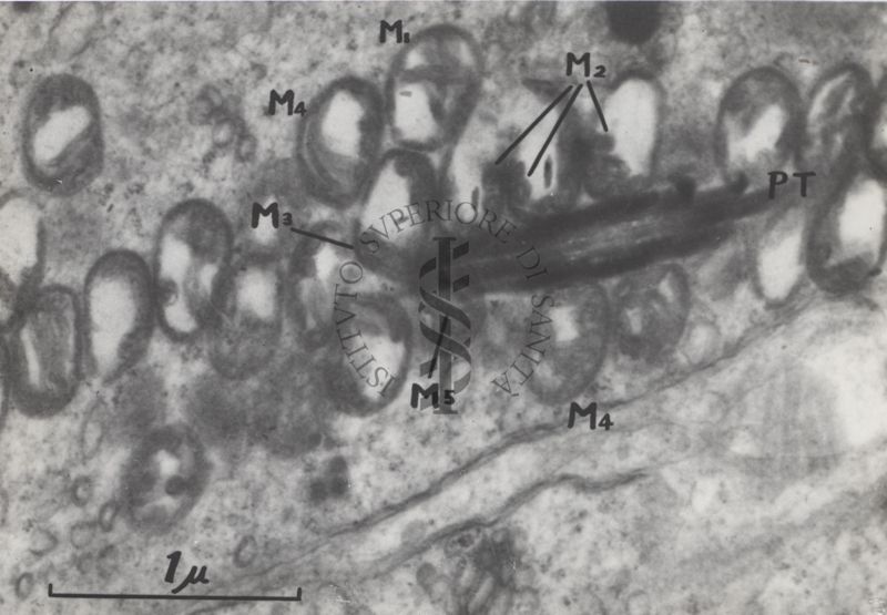 La spermatogenesi studiata al Microscopio elettronico