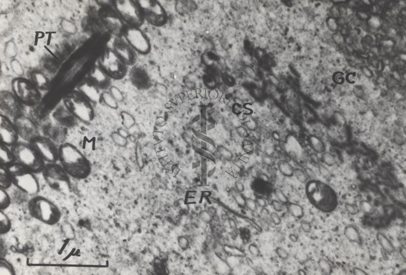 La spermatogenesi studiata al Microscopio elettronico