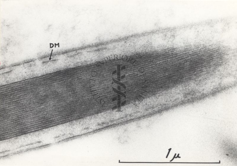 La spermatogenesi studiata al Microscopio elettronico