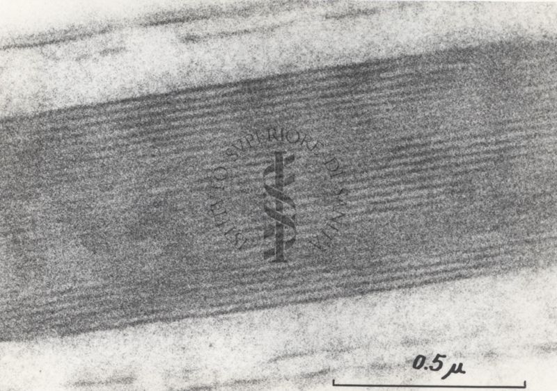 La spermatogenesi studiata al Microscopio elettronico