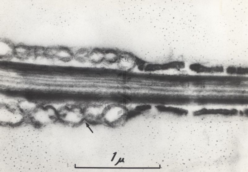 La spermatogenesi studiata al Microscopio elettronico