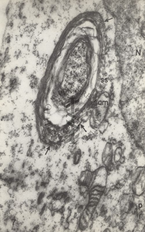 Formazioni di virus N.D.V. (Newcastle disease virus)