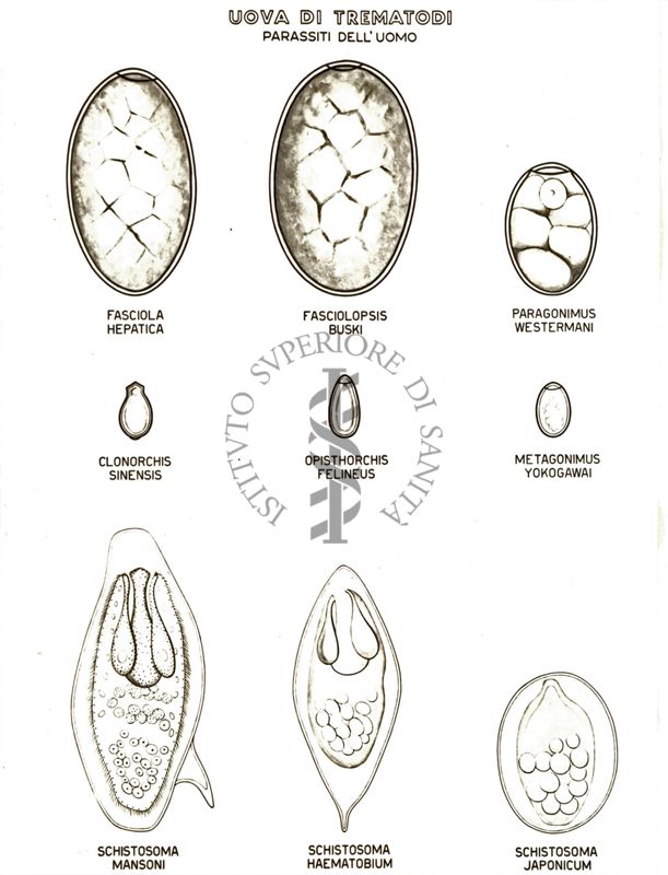 Uova di Trematodi (parassiti dell'uomo)