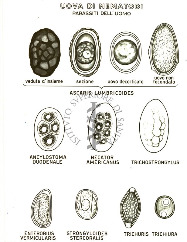 Uova di Nematodi (parassiti dell'uomo)