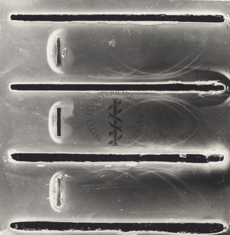 Immunoelettroforesi di tubercolare