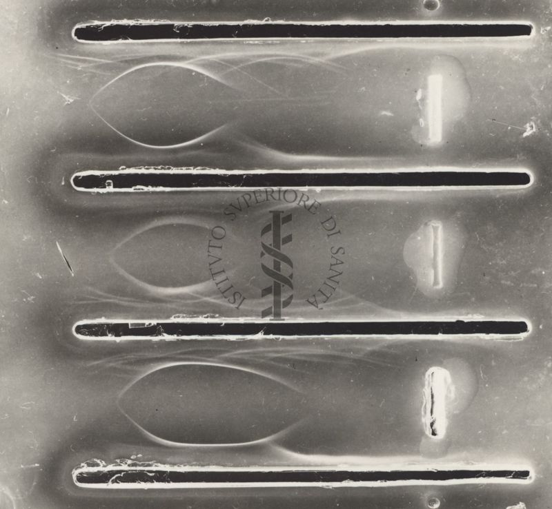 Immunoelettroforesi di tubercolare