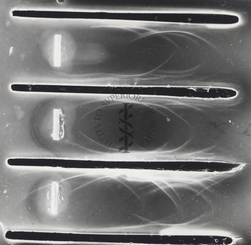 Immune elettroforesi di tubercolare