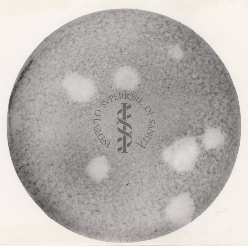 Immagini al microscopio di colture in piastra