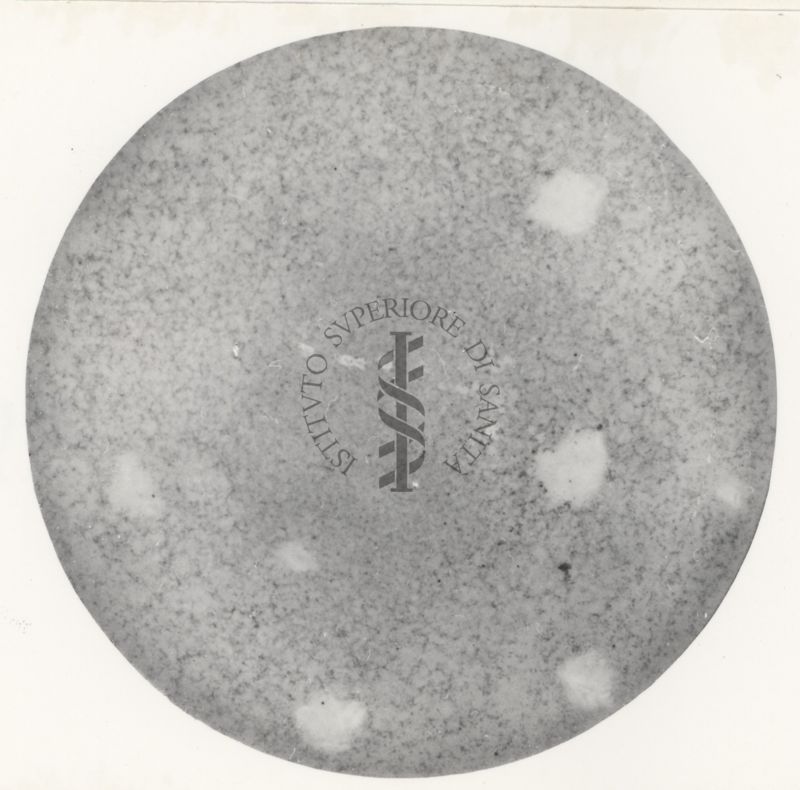 Immagine al microscopio di coltura in piastra