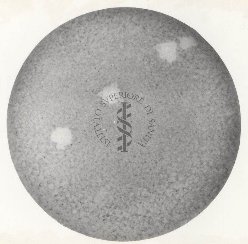 Immagine al microscopio di coltura in piastra