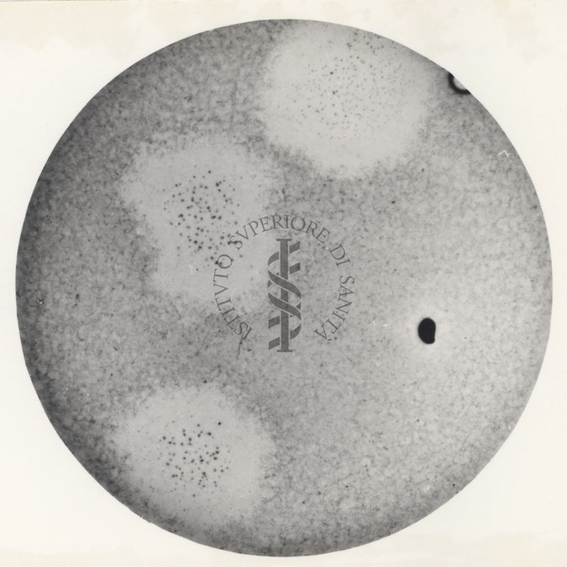 Immagine al microscopio di coltura in piastra