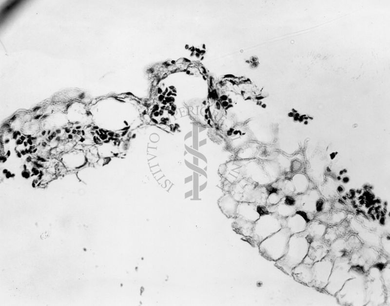 Embrioni inoculati con materiale leucemico umano con e senza filtrazioni da Scitz. Controlli relativi