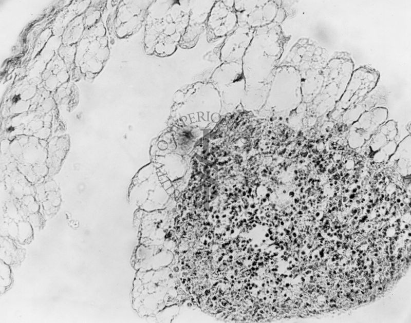 Embrioni inoculati con materiale leucemico umano con e senza filtrazioni da Scitz. Controlli relativi