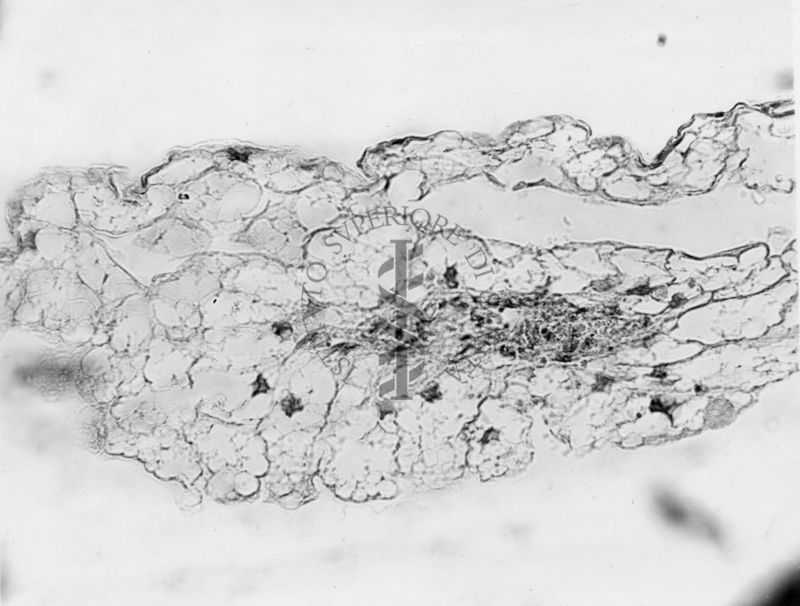 Embrioni inoculati con materiale leucemico umano con e senza filtrazioni da Scitz. Controlli relativi