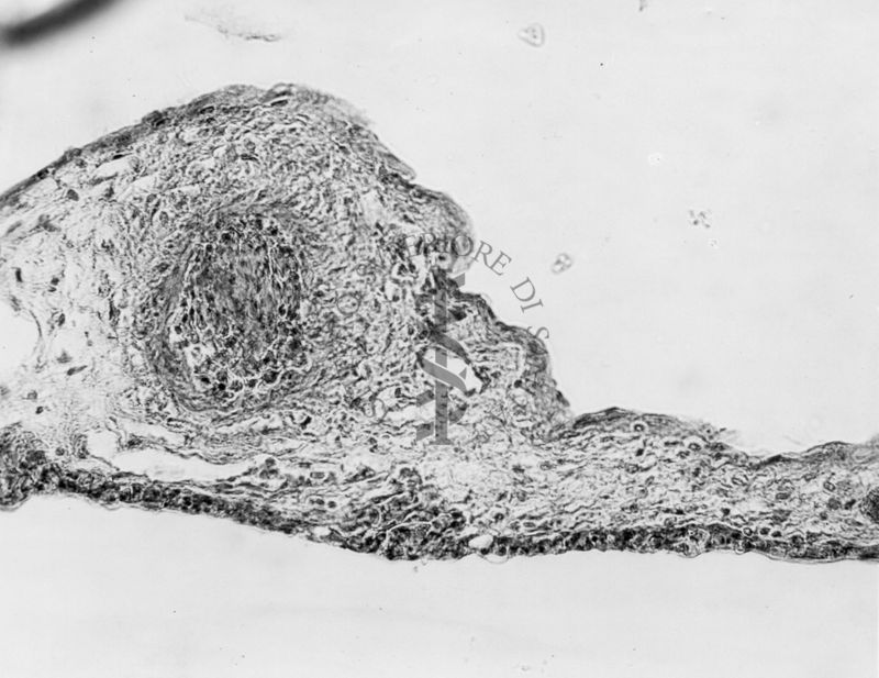 Embrioni inoculati con materiale leucemico umano con e senza filtrazioni da Scitz. Controlli relativi