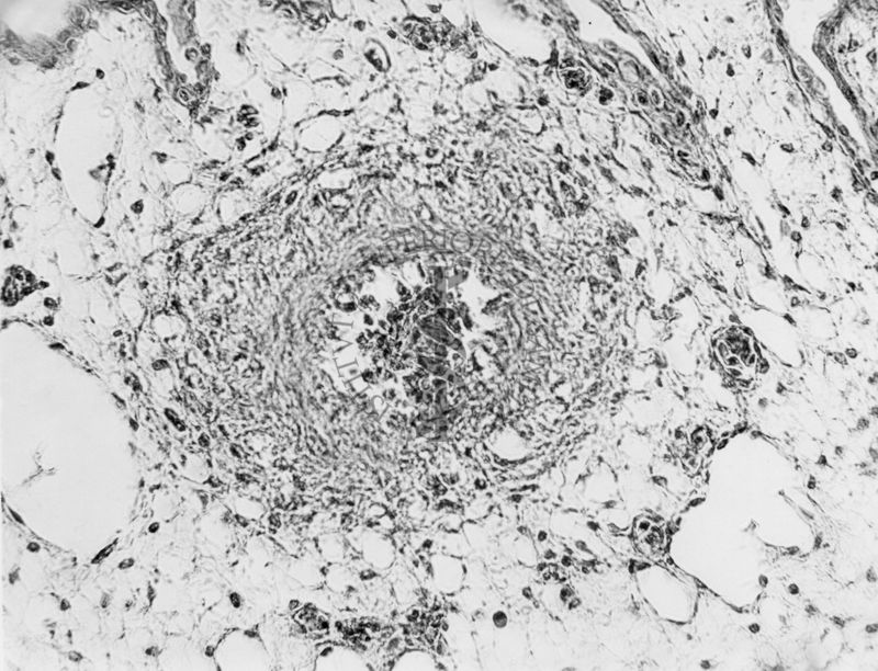 Embrioni inoculati con materiale leucemico umano con e senza filtrazioni da Scitz. Controlli relativi