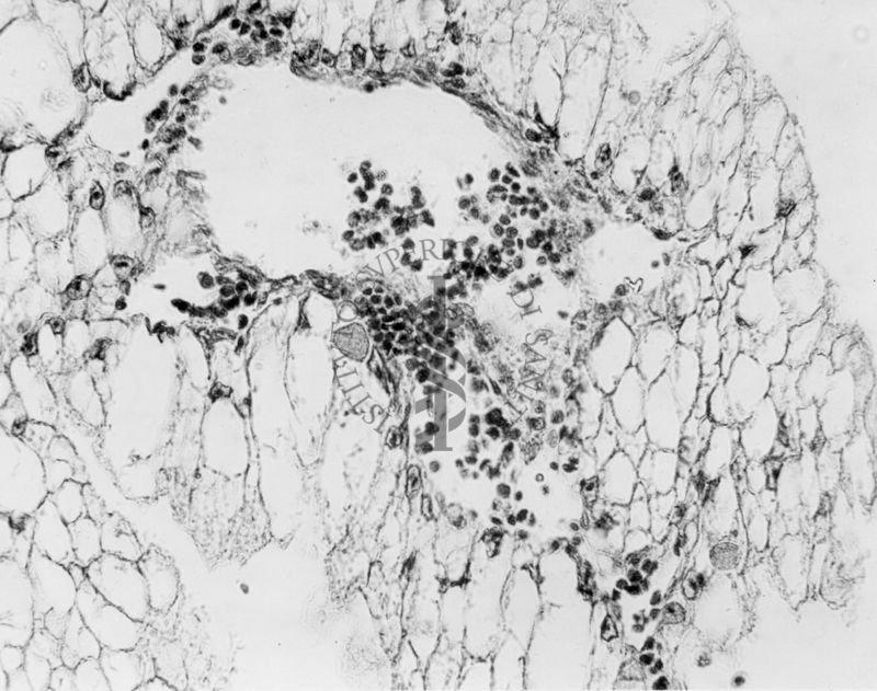 Embrioni inoculati con materiale leucemico umano con e senza filtrazioni da Scitz. Controlli relativi