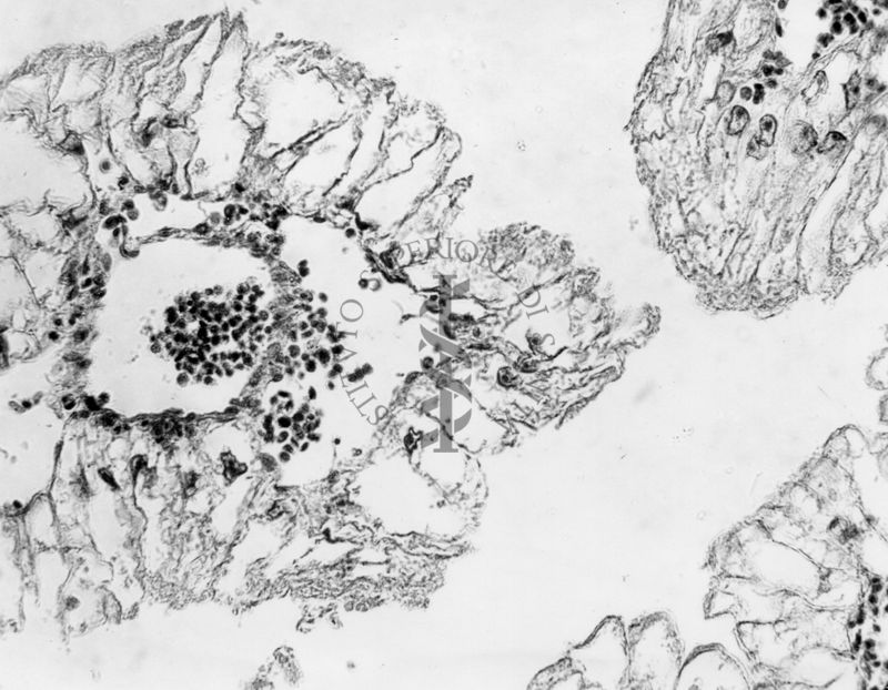 Embrioni inoculati con materiale leucemico umano con e senza filtrazioni da Scitz. Controlli relativi