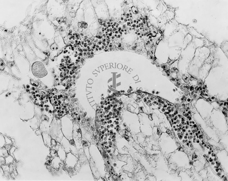 Embrioni inoculati con materiale leucemico umano con e senza filtrazioni da Scitz. Controlli relativi