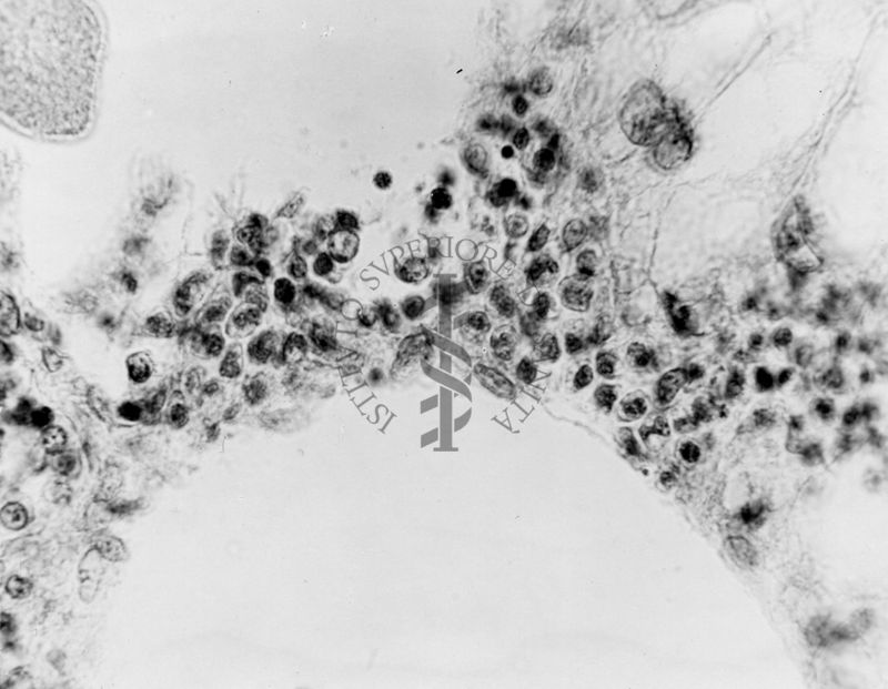 Embrioni inoculati con materiale leucemico umano con e senza filtrazioni da Scitz. Controlli relativi