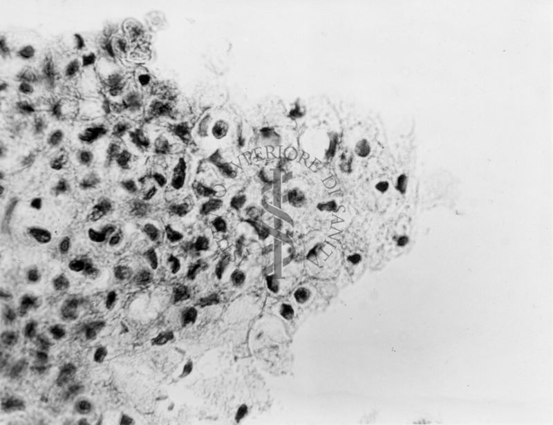 Embrioni inoculati con materiale leucemico umano con e senza filtrazioni da Scitz. Controlli relativi