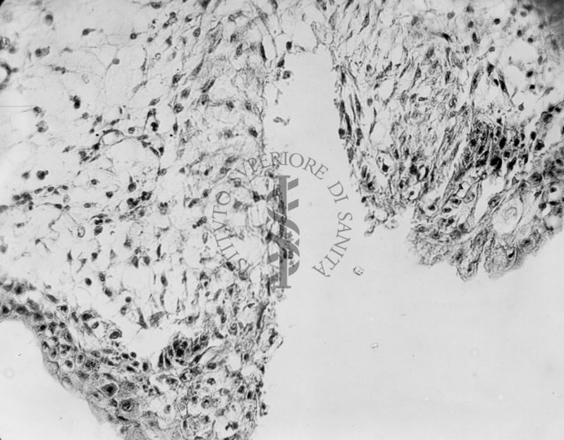 Embrioni inoculati con materiale leucemico umano con e senza filtrazioni da Scitz. Controlli relativi